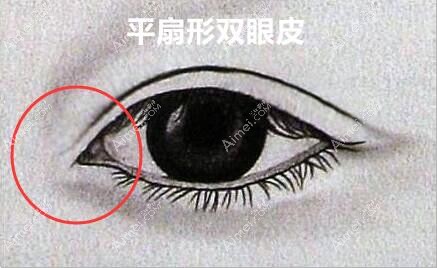 平扇型双眼皮图片 平扇型双眼皮图片