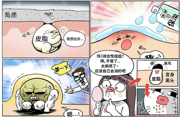 激光祛痘印痘坑亲身经历 激光祛痘印痘坑亲身经历