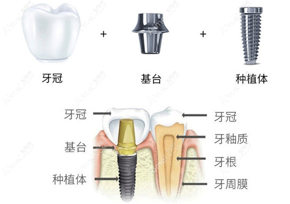 表面处理各占优势 表面处理各占优势