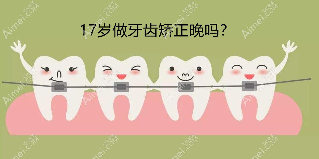 17岁矫正牙齿晚吗 17岁矫正牙齿晚吗