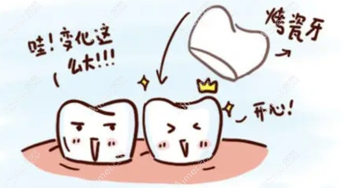 烤瓷牙前后变化 烤瓷牙前后变化