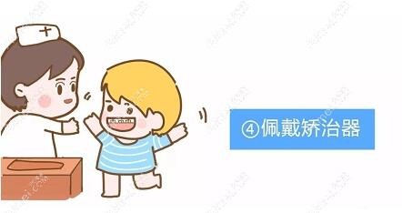 儿童出现咬合问题,要及时矫正 儿童出现咬合问题,要及时矫正