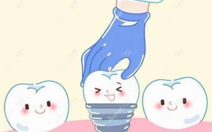 韩国登特斯种植牙的优缺点 韩国登特斯种植牙的优缺点