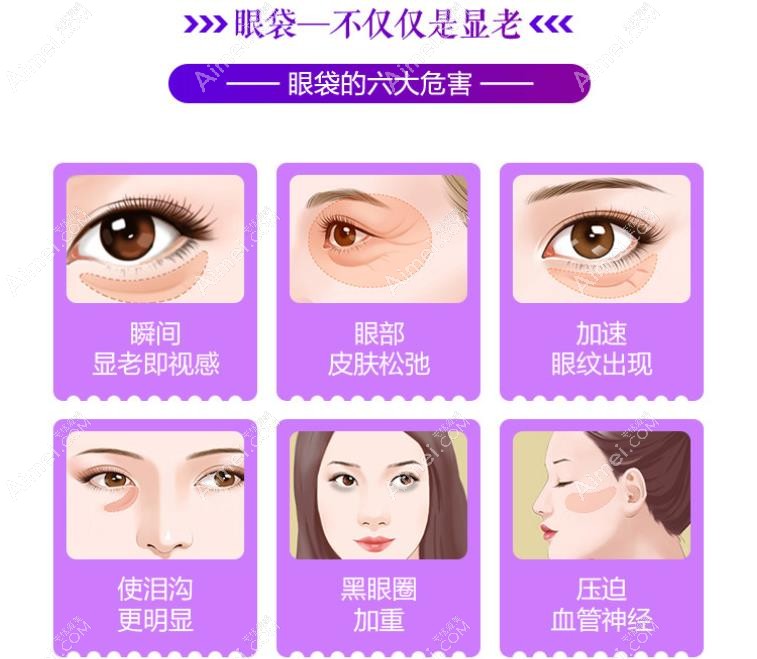天生黑眼圈和眼袋不做手术消除的简单方法有哪些 天生黑眼圈和眼袋不做手术消除的简单方法有哪些