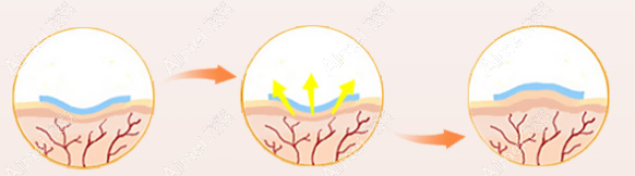 去疤痕的方法 去疤痕的方法