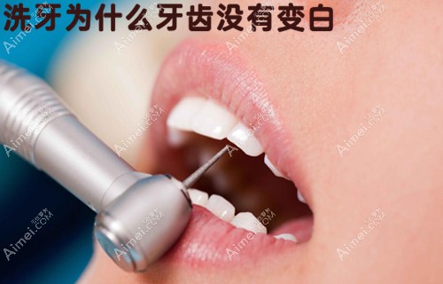洗牙后为什么牙齿没有变白？可能跟自己牙黄的原因有关