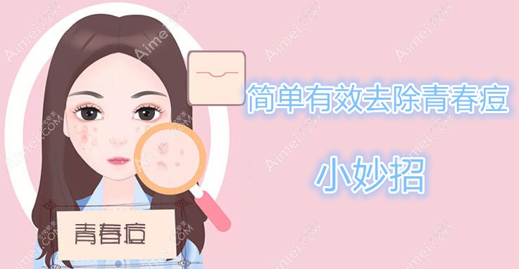 简单有效的去除青春痘的小妙招 简单有效的去除青春痘的小妙招