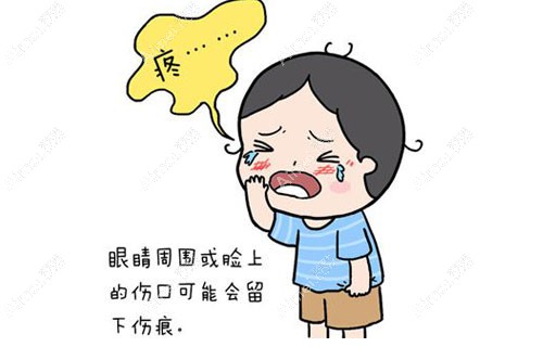 脸部拆线后几天可以沾水，面部创伤缝合拆线后的注意事项