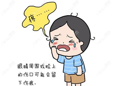 脸部拆线前不能沾水洗脸以免感染.jpg 脸部拆线前不能沾水洗脸以免感染.jpg