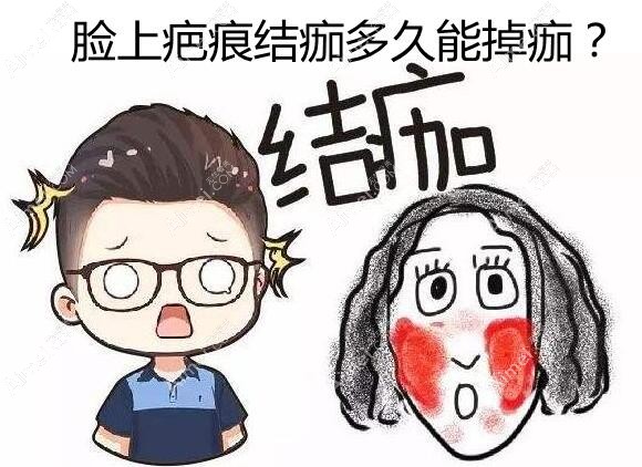 脸上疤痕结痂多久能掉痂?自然脱落和人为掉痂的区别要知道