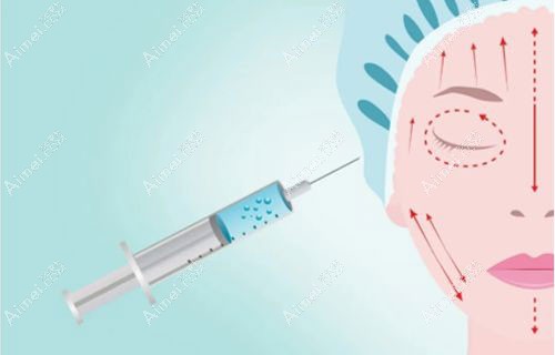 进口玻尿酸哪个牌子好？2025比较好的国外品牌看这份排名榜