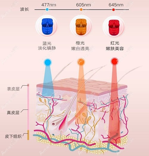 光子嫩肤缩小毛孔 光子嫩肤缩小毛孔