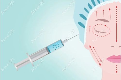选择进口玻尿酸品牌注射面部.jpg 选择进口玻尿酸品牌注射面部.jpg