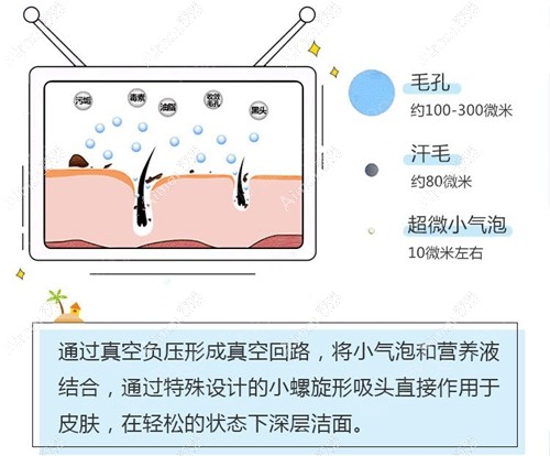 小气泡清洁毛孔 小气泡清洁毛孔