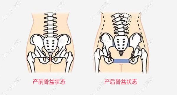 产前产后女性骨盆对比 产前产后女性骨盆对比