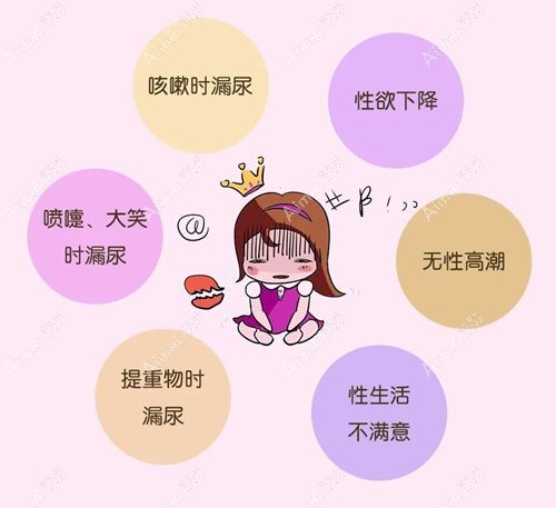 阴道松弛做埋线缩阴手术.jpg 阴道松弛做埋线缩阴手术.jpg