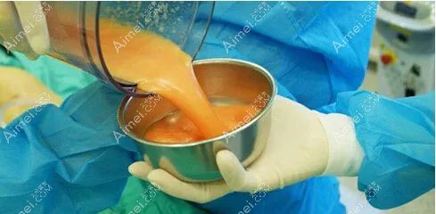 自体脂肪丰胸三四年的危害和副作用有两点m.dlren.com.jpg 自体脂肪丰胸三四年的危害和副作用有两点m.dlren.com.jpg