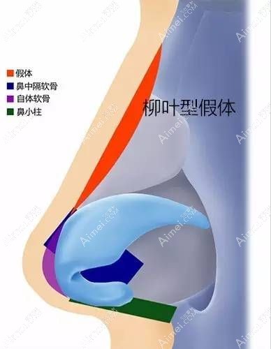 柳叶型假体加耳软骨隆鼻的副作用:是否会下滑/穿孔一文秒懂