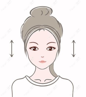 术后睁眼费力属于8种双眼皮失败表现.jpg 术后睁眼费力属于8种双眼皮失败表现.jpg