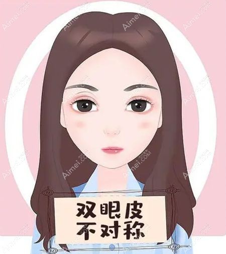双眼皮不对称也是双眼皮失败的八种表现.jpg 双眼皮不对称也是双眼皮失败的八种表现.jpg