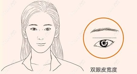 双眼皮线条弧度生硬属于双眼皮8种失败表现m.51dlren.com.jpg 双眼皮线条弧度生硬属于双眼皮8种失败表现m.51dlren.com.jpg