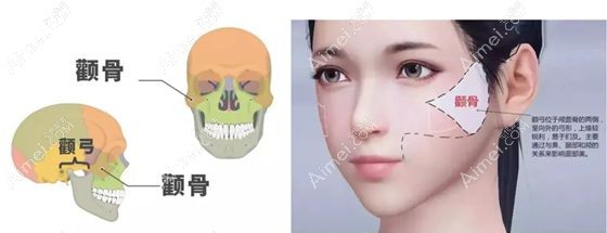 颧骨颧弓内推能推几毫米好看m.dlren.com.jpg 颧骨颧弓内推能推几毫米好看m.dlren.com.jpg