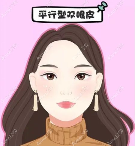 两眼间距宽适合什么形状的双眼皮?7mm/8mm平行双眼皮更好看哦