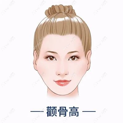 颧骨高图片.jpg 颧骨高图片.jpg