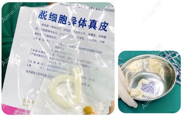 第五代3d生物束带紧缩术费用公布www.dlren.com.jpg 第五代3d生物束带紧缩术费用公布www.dlren.com.jpg