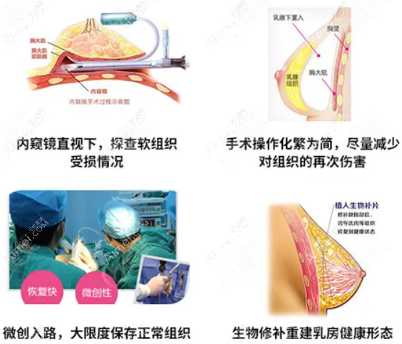 广州荔湾区人民医院清奥术 广州荔湾区人民医院清奥术