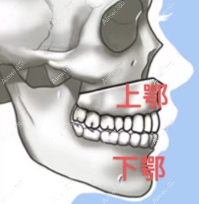 广州广大正颌手术 广州广大正颌手术
