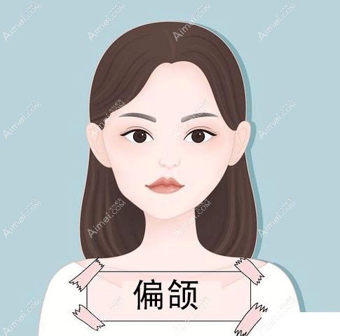 偏颌不治疗会越来越越偏吗？小孩轻微偏颌有必要手术吗？