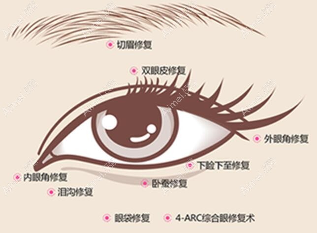 北京眼修复手术类型多dlren.com 北京眼修复手术类型多dlren.com