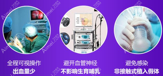 广州美莱内窥镜假体隆胸手术dlren.com