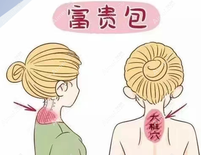 成都润美玉之光去富贵包位置 成都润美玉之光去富贵包位置