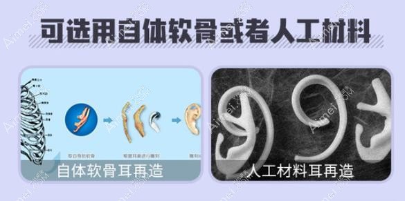 北京煤医整形医院耳再造做的好吗 北京煤医整形医院耳再造做的好吗