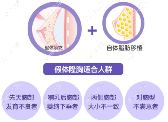 1万多、2万的假体隆胸可以吗 1万多、2万的假体隆胸可以吗