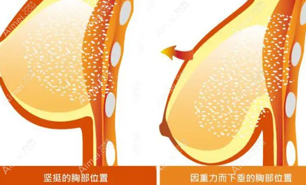 乳房下垂悬吊手术价格多少钱dlren.com 乳房下垂悬吊手术价格多少钱dlren.com