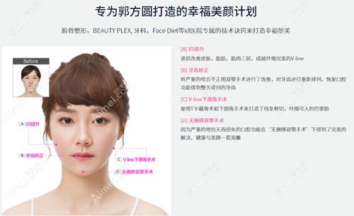 郭方圆在id做完双鄂及牙齿矫正前后对比图.jpg 郭方圆在id做完双鄂及牙齿矫正前后对比图.jpg
