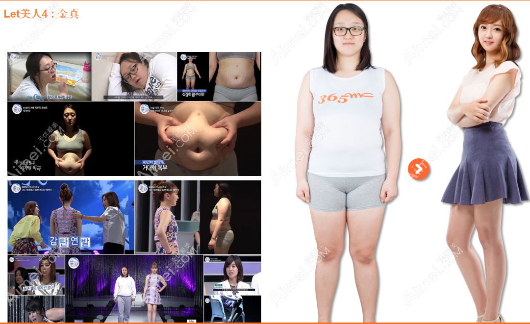 韩国365mc吸脂医院抽脂对比图 韩国365mc吸脂医院抽脂对比图