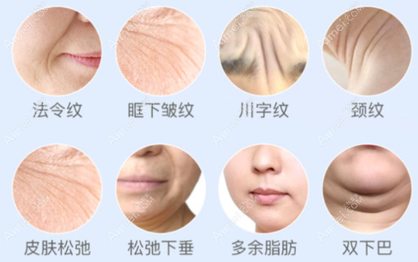 超声炮和热玛吉功效区别 超声炮和热玛吉功效区别