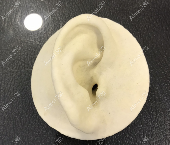 profile进行耳再造手轮廓 profile进行耳再造手轮廓