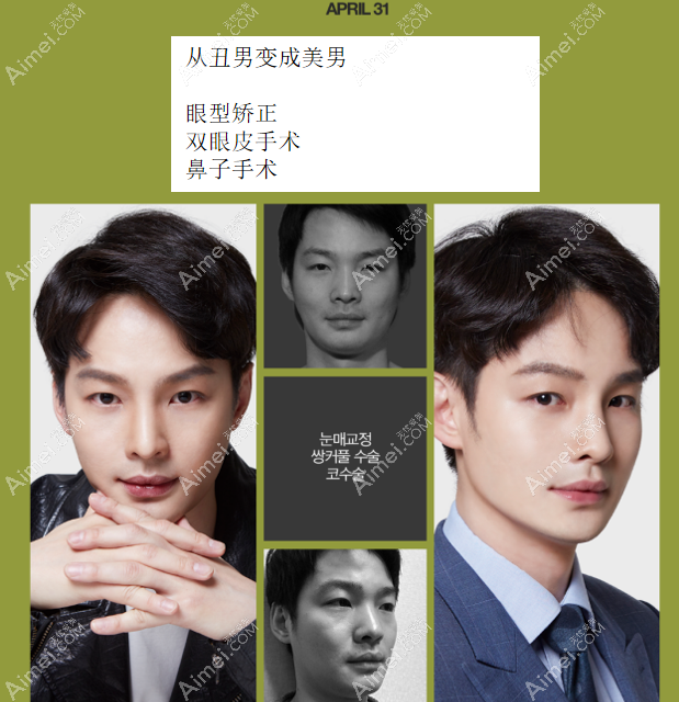 韩国431医院吴原硕院长做眼睛鼻子怎么样 韩国431医院吴原硕院长做眼睛鼻子怎么样