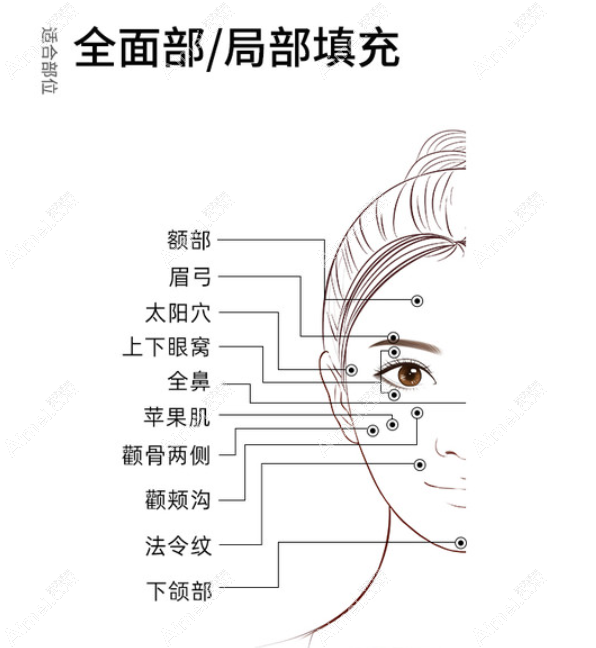 北京润美玉之光张红芳医生脂肪填充怎么样 北京润美玉之光张红芳医生脂肪填充怎么样