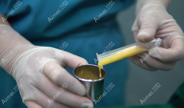 北京润美玉之光王明利医生脂肪填充怎么样 北京润美玉之光王明利医生脂肪填充怎么样