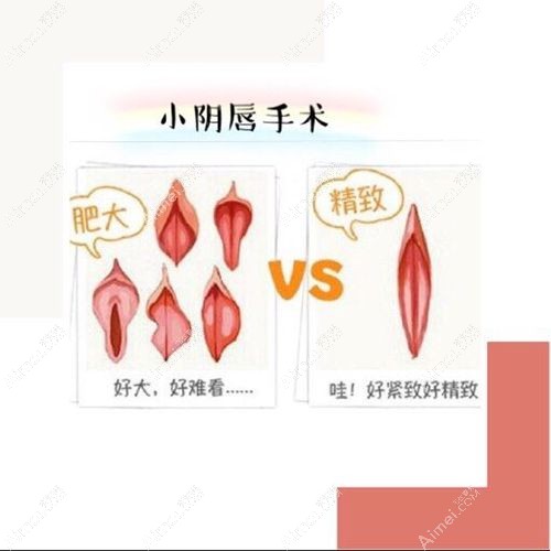 韩国女性私密整形医院排名top10分享m.dlren.com.jpg 韩国女性私密整形医院排名top10分享m.dlren.com.jpg