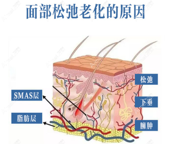 面部衰老的症状表现 面部衰老的症状表现