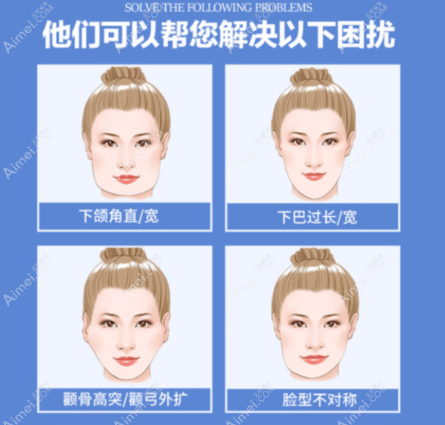 四川友谊医院李继华磨骨怎么样