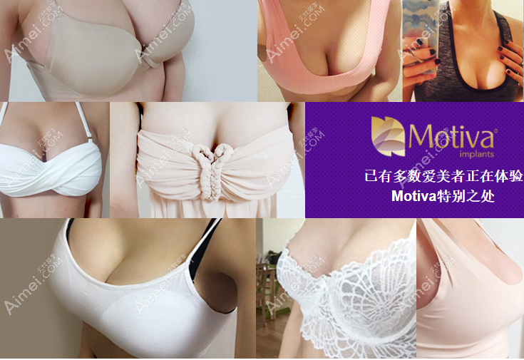 韩国棒棒BONGBONG整形外科隆胸实例多 韩国棒棒BONGBONG整形外科隆胸实例多