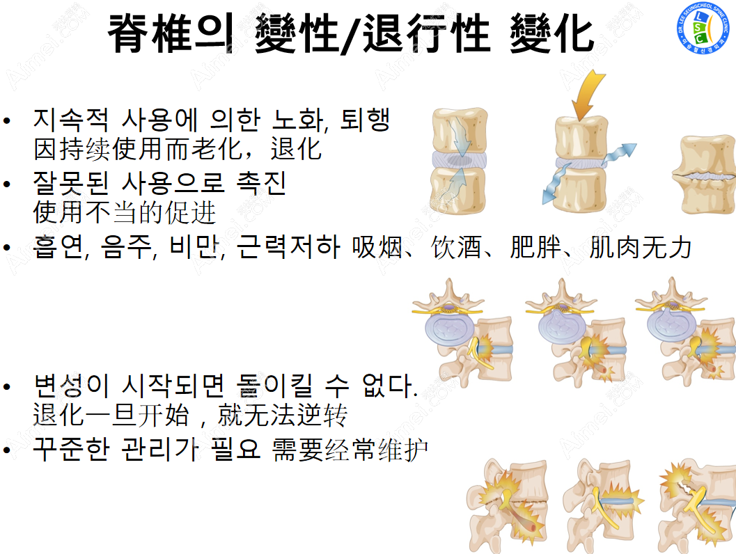 韩国李承哲神经外科腰椎病治疗价格表 韩国李承哲神经外科腰椎病治疗价格表
